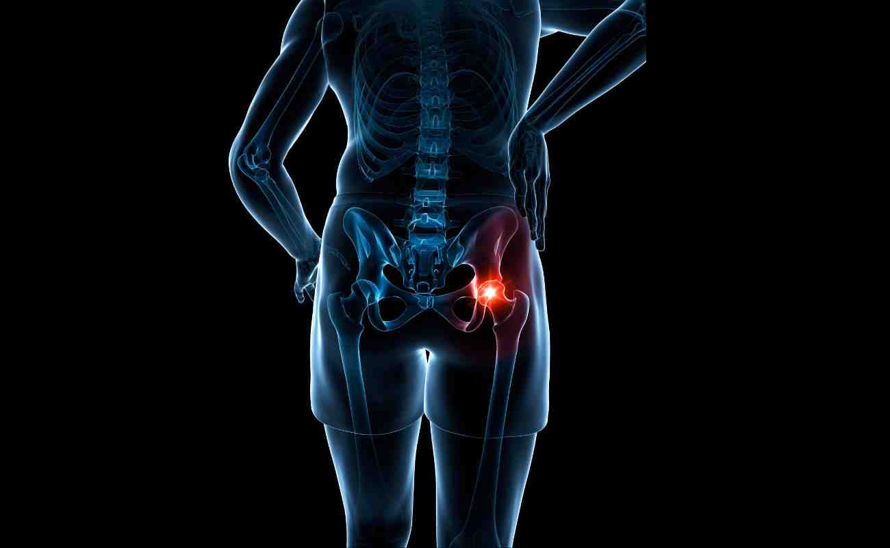 Hip pain - Curezone Physiotherapy
