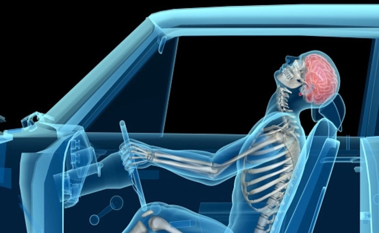 whiplash-injury-graphic