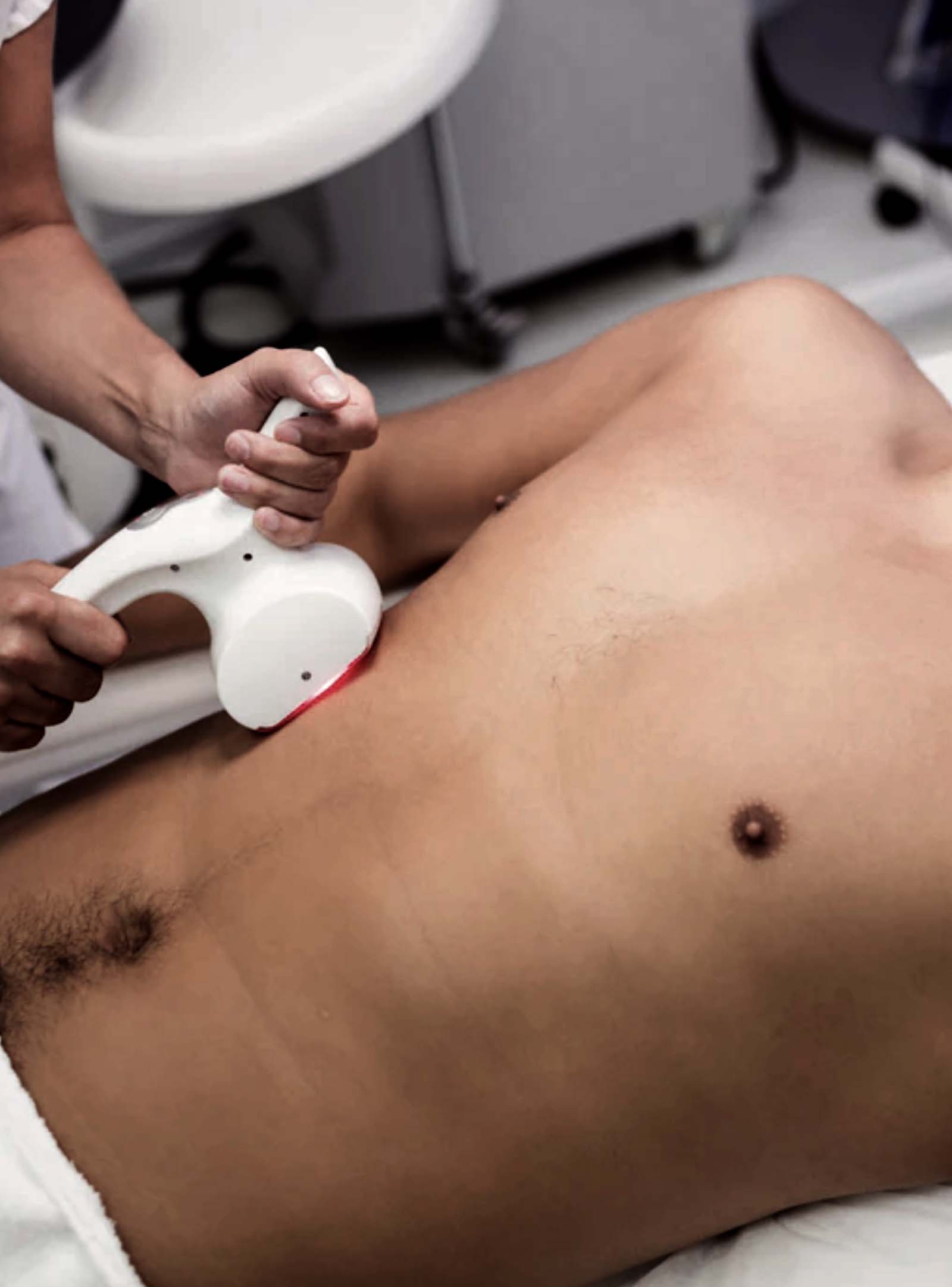 Laser Therapy Clinic in Mississauga